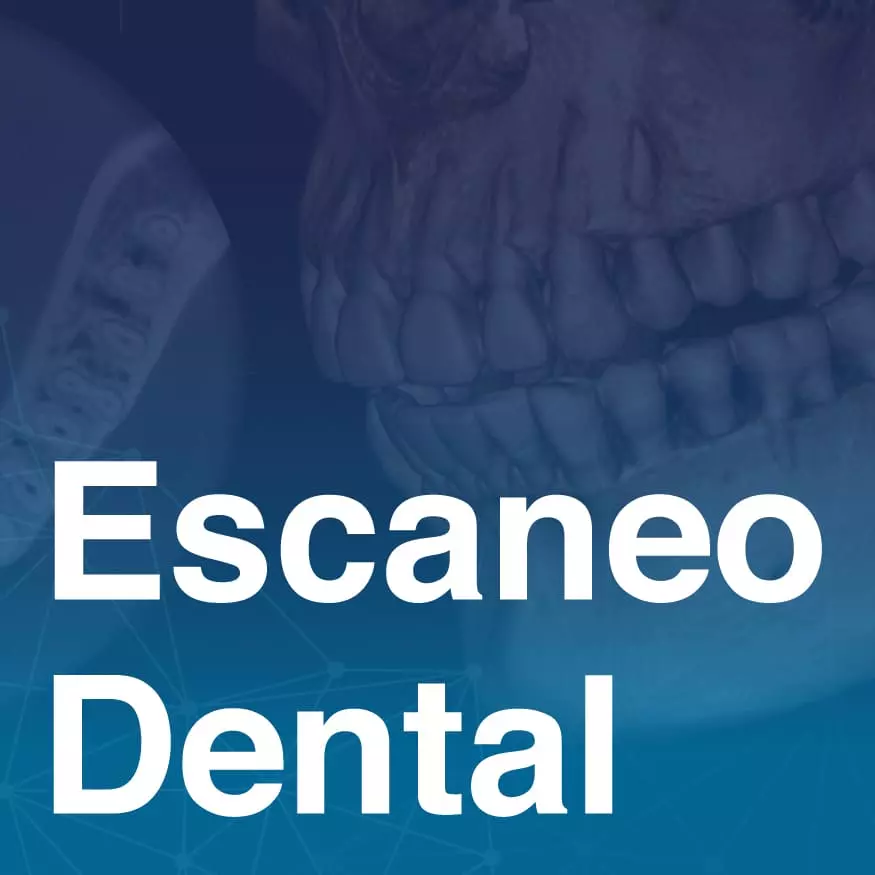 Escaneo_dental