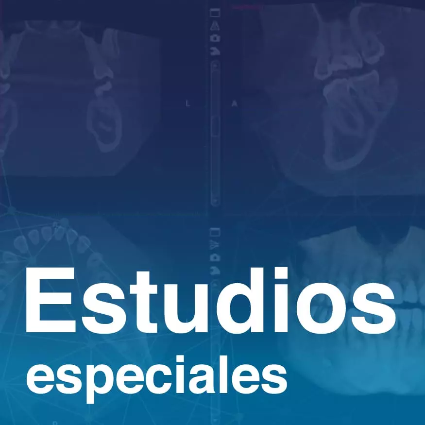 Estudios_especiales