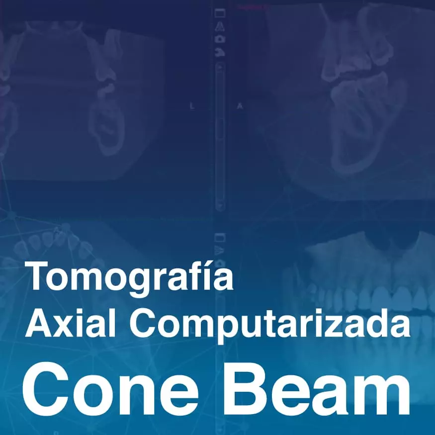 tac_cone_beam